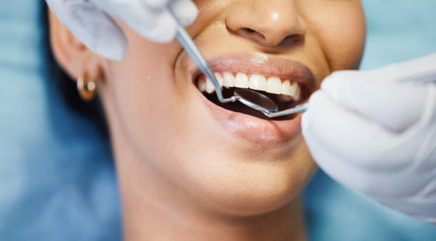 Best Emergency Dentist for Lost Fillings or Crowns in Seatac, WA