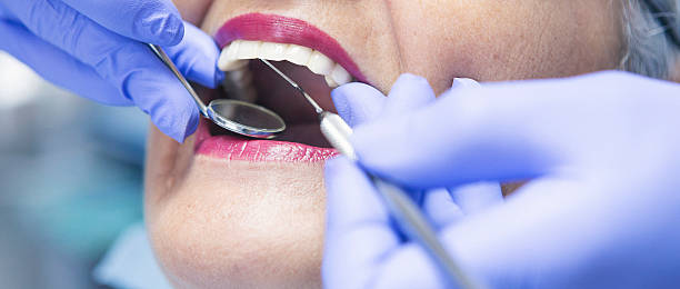 Best Emergency Dentist for Lost Fillings or Crowns in Seatac, WA